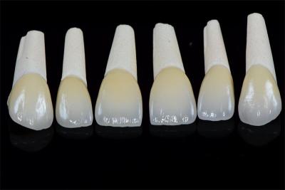 Long Lasting Permanent White Dental Porcelain Veneers Stain Resistance