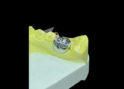 Long-lasting Function Durable Full Metal Cast Crown for Superior Tooth Restoration